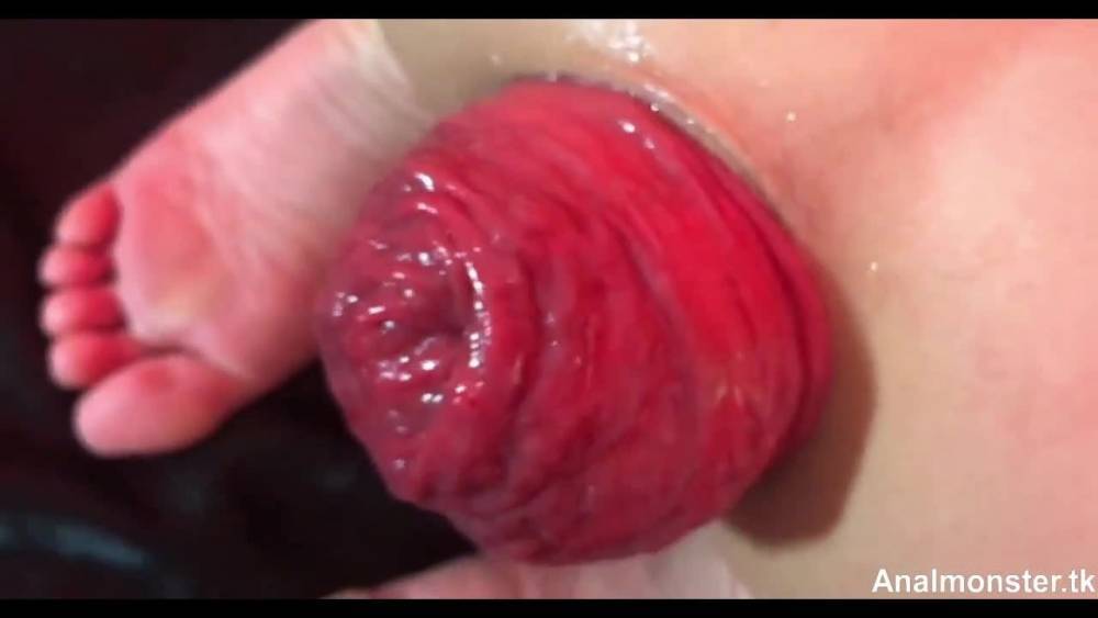 Huge anal prolapse ruined very closeup - xh.video