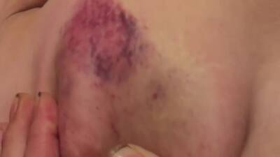 I Asked My Dom To Film Me Being Messed With While Sleepy And Bruised. 20 Min - hclips.com
