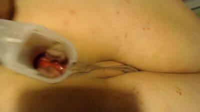 Anal Speculum And Show Inside My Asshole Part 2 - hclips.com