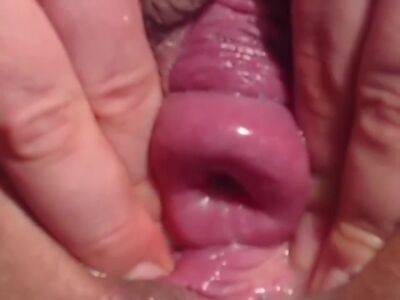 Cervix Show, Big Objects In Pussy,fisting,dp,squirt - hclips.com