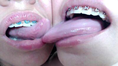 Deep tounge kissing between two brace lesbian - hclips.com