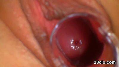 Fervent Girl Is Spreading Tight Twat In Closeup And Com - videomanysex.com