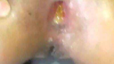 Daddy Stretches Teen's Big Ass Wide Open - Rough Anal Sex with Colombian Culona - xxxfiles.com - Colombia